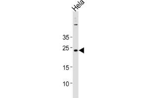 Western Blotting (WB) image for anti-Cappuccino Homolog (CNO) antibody (ABIN3004642) (BLOC1S4 Antikörper)