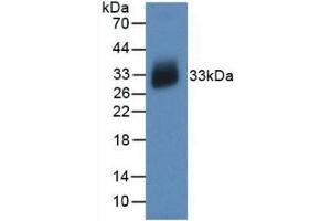 Detection of Recombinant IL12A, Human using Monoclonal Antibody to Interleukin 12A (IL12A) (IL12A Antikörper  (AA 23-219))
