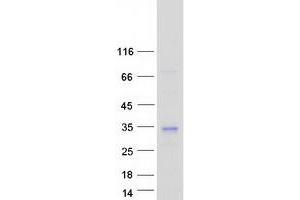 Western Blotting (WB) image for MOB Family Member 4, Phocein (MOBKL3) (Transcript Variant 1) protein (Myc-DYKDDDDK Tag) (ABIN2726214)