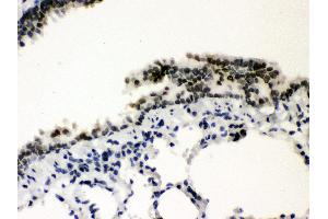 Immunohistochemistry (Paraffin-embedded Sections) (IHC (p)) image for anti-Sp3 Transcription Factor (Sp3) (AA 569-599), (C-Term) antibody (ABIN3043350) (Sp3 Antikörper  (C-Term))