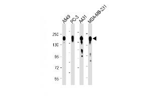 All lanes : Anti-EGFR Antibody (C-term) at 1:8000 dilution Lane 1: A549 whole cell lysate Lane 2: PC-3 whole cell lysate Lane 3: A431 whole cell lysate Lane 4: MDA-MB-231 whole cell lysate Lysates/proteins at 20 μg per lane. (EGFR Antikörper  (C-Term))