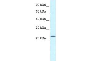 WB Suggested Anti-ZA20D3 Antibody Titration:  2. (ZFAND6 Antikörper  (Middle Region))