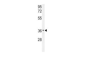 IGFBP3- (ABIN391976 and ABIN2841769) western blot analysis in mouse stomach tissue lysates (15 μg/lane). (IGFBP3 Antikörper  (AA 162-189))