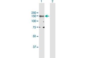 Western Blot analysis of DNMT3A expression in transfected 293T cell line by DNMT3A MaxPab polyclonal antibody. (DNMT3A Antikörper  (AA 1-912))