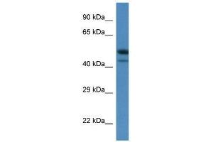Western Blot showing Sbk1 antibody used at a concentration of 1. (SBK1 Antikörper  (C-Term))