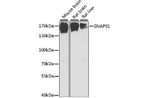 Western blot analysis of extracts of various cell lines, using SNAP91 antibody (ABIN2560041) at 1:1000 dilution. (SNAP91 Antikörper)