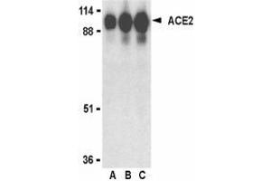Western blot analysis of ACE2 in human kidney lysate with AP30006PU-N ACE2 antibody at (A) 0. (ACE2 Antikörper  (Intermediate Domain 1))