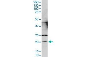 CCDC12 monoclonal antibody (M05), clone 7B1.