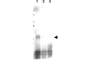 Image no. 2 for anti-CD151 (CD151) (AA 26-35), (pSer30) antibody (ABIN401337)