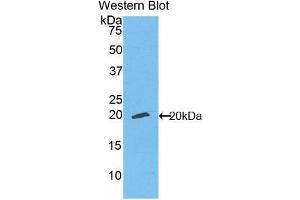Figure. (ENPP1 Antikörper  (Biotin))