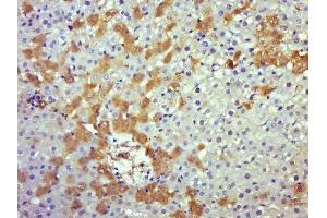 Immunohistochemistry (Paraffin-embedded Sections) (IHC (p)) image for anti-Caspase 8 (CASP8) (AA 188-280) antibody (ABIN1386778)