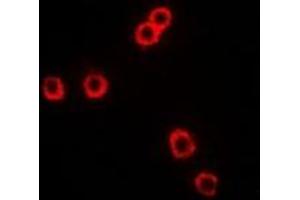 Immunofluorescent analysis of CD281 staining in Hela cells.