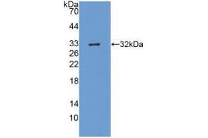 Western blot analysis of recombinant Mouse Kim1.