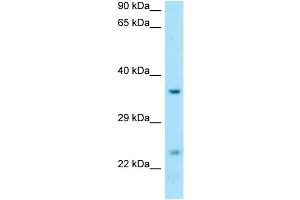 WB Suggested Anti-DTD1 Antibody Titration: 1. (DTD1 Antikörper  (C-Term))