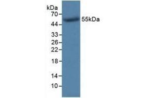 Detection of Recombinant TK1, Human using Monoclonal Antibody to Thymidine Kinase 1, Soluble (TK1) (TK1 Antikörper  (AA 2-234))
