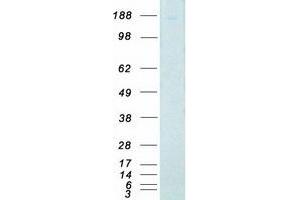 Western Blotting (WB) image for Death-Associated Protein Kinase 1 (DAPK1) protein (Myc-DYKDDDDK Tag) (ABIN2719216)