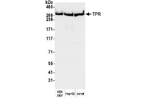 Western Blotting (WB) image for anti-Nucleoprotein TPR (TPR) (C-Term) antibody (ABIN7455083)