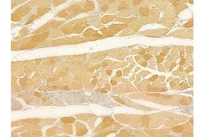 ABIN6262391 and ABIN6269042 at 1/100 staining human tongue carcinoma by IHC-P. (HSPB6 Antikörper  (N-Term))