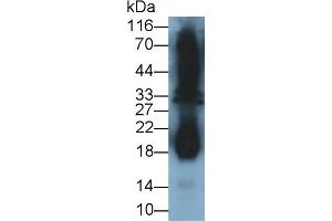 Detection of IFNg in Cavia Testis lysate using Polyclonal Antibody to Interferon Gamma (IFNg) (Interferon gamma Antikörper  (AA 24-166))