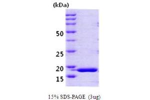 PPIH Protein (AA 1-177)