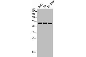 Western blot analysis of HELA KB SH-SY5Y lysis using RRS1 antibody.