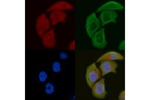 ABIN6261241 and ABIN6276878 staining Hela cells by IF/ICC.