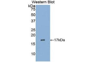 Western Blotting (WB) image for anti-Leukemia Inhibitory Factor Receptor alpha (LIFR) (AA 45-184) antibody (ABIN3208382) (LIFR Antikörper  (AA 45-184))