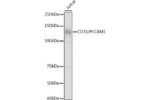 Western blot analysis of extracts of Jurkat cells, using CD31/PEC antibody (ABIN3022923, ABIN3022924, ABIN3022925 and ABIN6219299) at 1:1000 dilution. (CD31 Antikörper  (AA 130-230))