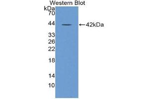 Western Blotting (WB) image for anti-Nuclear Factor kappa B (NFkB) (AA 805-892) antibody (ABIN1980478) (NFkB Antikörper  (AA 805-892))
