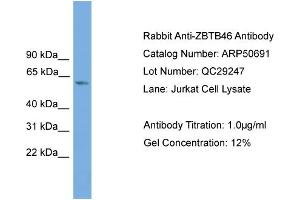 WB Suggested Anti-ZBTB46  Antibody Titration: 0. (ZBTB46 Antikörper  (Middle Region))