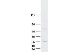 Western Blotting (WB) image for Transmembrane Protein 126A (TMEM126A) protein (Myc-DYKDDDDK Tag) (ABIN2733846)