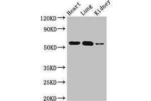 Western Blot Positive WB detected in: Mouse heart tissue, Mouse lung tissue, Mouse kidney tissue All lanes: SMAD5 antibody at 3 μg/mL Secondary Goat polyclonal to rabbit IgG at 1/50000 dilution Predicted band size: 53 kDa Observed band size: 53 kDa