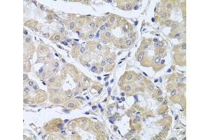Immunohistochemistry of paraffin-embedded Human stomach using CEP57L1 Polyclonal Antibody at dilution of 1:100 (40x lens). (CEP57L1 Antikörper)