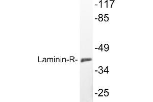 Western blot (WB) analyzes of Laminin-R antibody in extracts from K562 cells. (RPSA/Laminin Receptor Antikörper)