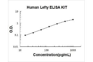 Typical Standard Curve