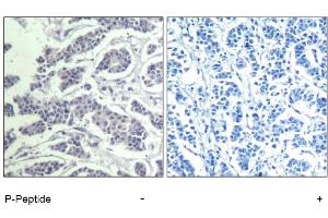 Image no. 1 for anti-V-Akt Murine Thymoma Viral Oncogene Homolog 1 (AKT1) (pTyr312), (pTyr315), (pTyr316) antibody (ABIN319269) (AKT1 Antikörper  (pTyr312, pTyr315, pTyr316))