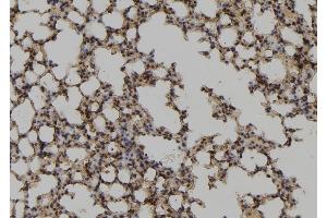 ABIN6278250 at 1/100 staining Mouse lung tissue by IHC-P. (UBE2M Antikörper  (Internal Region))