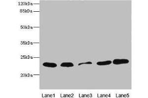 Western blot All lanes: TIMM23 antibody at 3. (TIMM23 Antikörper  (AA 1-209))