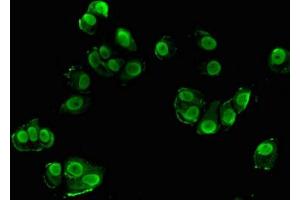 Immunofluorescent analysis of MCF-7 cells using ABIN7169815 at dilution of 1:100 and Alexa Fluor 488-congugated AffiniPure Goat Anti-Rabbit IgG(H+L) (SRGAP1 Antikörper  (AA 136-192))