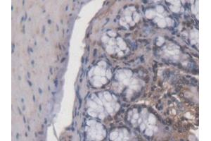 DAB staining on IHC-P; Samples: Mouse Colon Tissue (ACD Antikörper  (AA 21-175))
