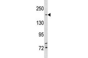 Western Blotting (WB) image for anti-Tuberous Sclerosis 2 (TSC2) (AA 479-508) antibody (ABIN3029312)