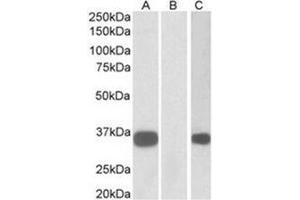 Western Blotting (WB) image for anti-Kv Channel Interacting Protein 3, Calsenilin (KCNIP3) (N-Term) antibody (ABIN1105647) (DREAM Antikörper  (N-Term))