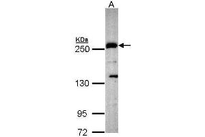 WB Image Sample (30 ug of whole cell lysate) A: Hep G2 , 5% SDS PAGE antibody diluted at 1:1000 (PLXND1 Antikörper  (C-Term))