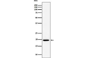 Western blot analysis of UFC1 expression in A549 cell lysate.