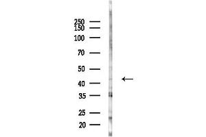 anti-Zinc Finger Protein 707 (ZNF707) antibody