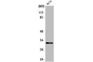 Western Blot analysis of Jurkat cells using AIG-1 Polyclonal Antibody (AIG1 Antikörper  (C-Term))