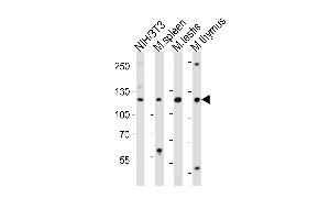 Western blot analysis of lysates from mouse NIH/3T3 cell line, mouse spleen, mouse testis, mouse thymus tissue lysate (from left to right), using Trim24 Antibody (C-term) (ABIN6244019 and ABIN6577664). (TRIM24 Antikörper  (C-Term))