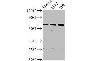Western Blot Positive WB detected in: Jurkat whole cell lysate, K562 whole cell lysate, 293 whole cell lysate All lanes: ELP3 antibody at 3. (ELP3/KAT9 Antikörper  (AA 1-85))