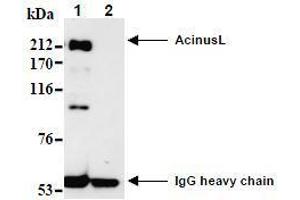 Western Blotting (WB) image for anti-Apoptotic Chromatin Condensation Inducer 1 (ACIN1) (AA 1-523), (N-Term) antibody (ABIN1105223) (ACIN1 Antikörper  (N-Term))