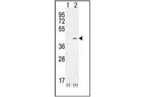 Western Blotting (WB) image for anti-Twinfilin, Actin-Binding Protein, Homolog 2 (Drosophila) (TWF2) (AA 35-65), (N-Term) antibody (ABIN955401)